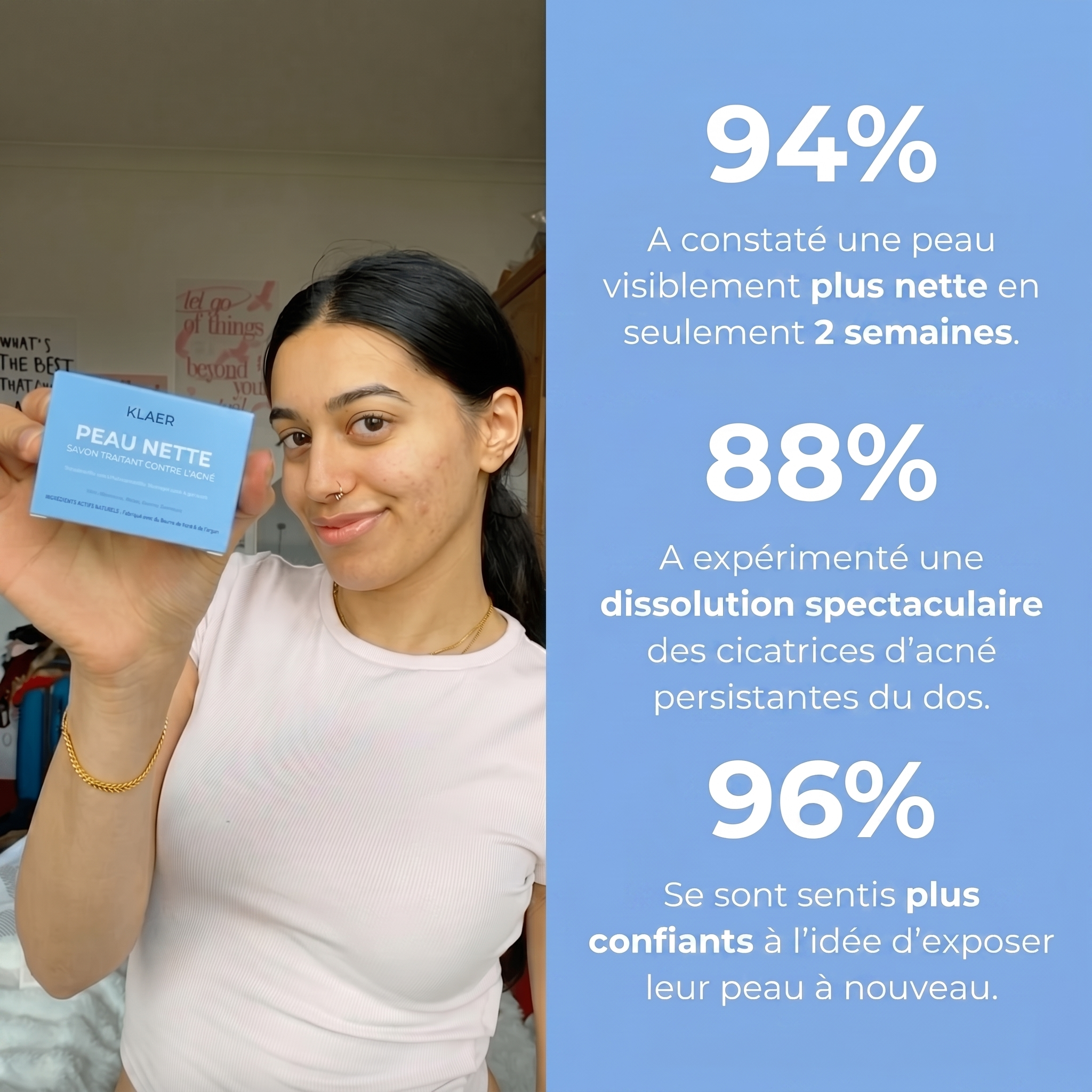 PEAU NETTE SAVON TRAITANT ANTI-ACNÉ